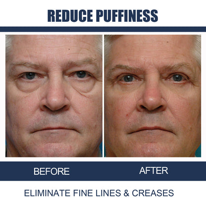 Men'S Anti-Aging Eye Cream